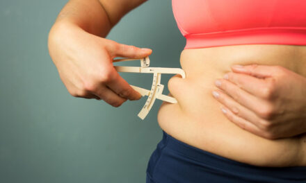 Tummy Tuck Cost: U.S. Price Factors, Fees & Financing