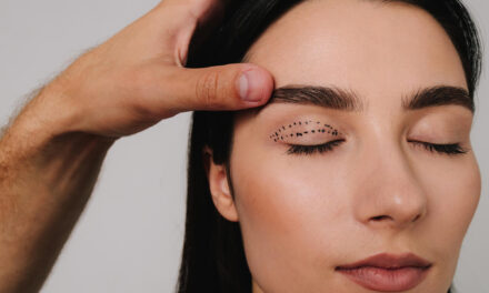 Eyelid Surgery (Blepharoplasty) Cost: U.S. Price Factors, Fees & Financing