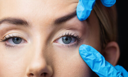 Eyelid Surgery (Blepharoplasty) Recovery: Week-by-Week Timeline & Practical Planning