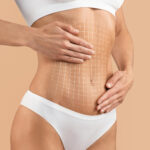 Tummy Tuck: Complete Guide to Cost, Recovery, Risks & Results