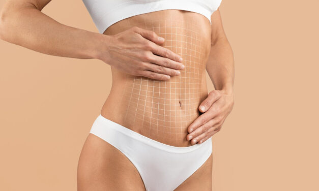 Tummy Tuck: Complete Guide to Cost, Recovery, Risks & Results