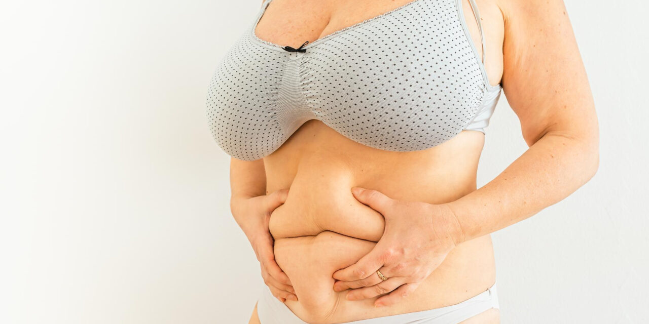 Tummy Tuck Techniques Explained: How Approaches Differ