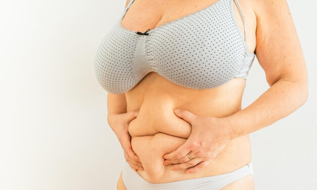 Tummy Tuck Techniques Explained: How Approaches Differ