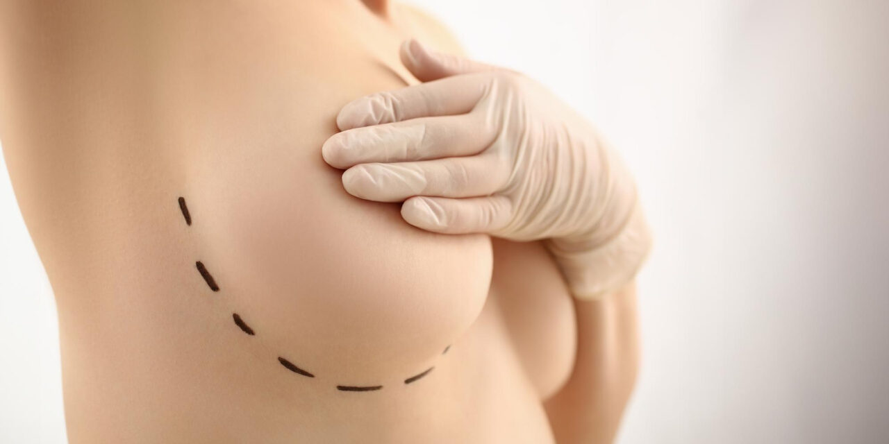 Breast Lift Before and After Photos: How to Evaluate Results Safely