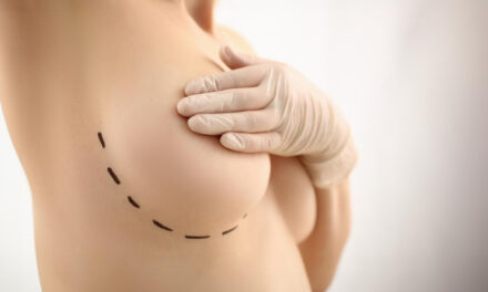 Breast Lift Before and After Photos: How to Evaluate Results Safely