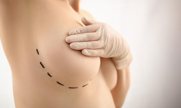 Breast Lift Before and After Photos: How to Evaluate Results Safely