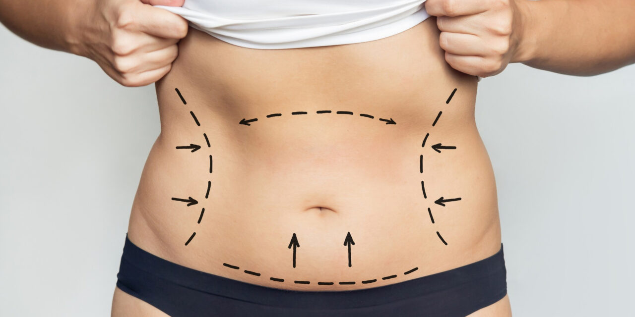 Mommy Makeover: Complete Guide to Cost, Recovery, Risks & Results