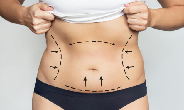 Mommy Makeover: Complete Guide to Cost, Recovery, Risks & Results