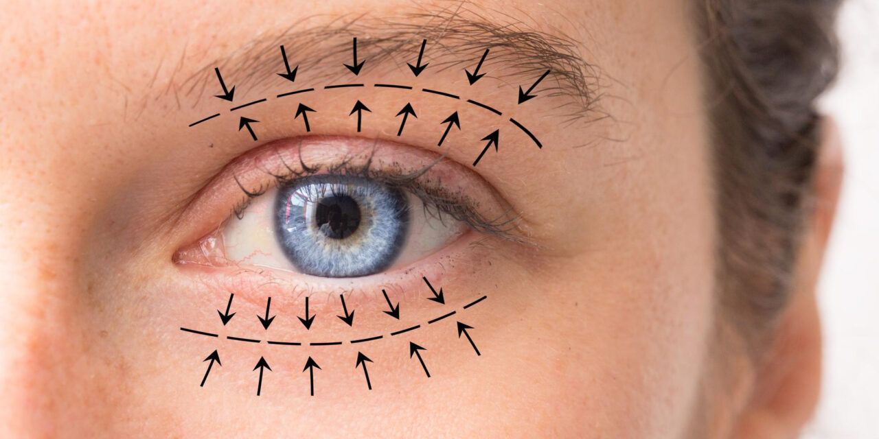 Eyelid Surgery (Blepharoplasty) Risks and Complications: What Patients Should Know